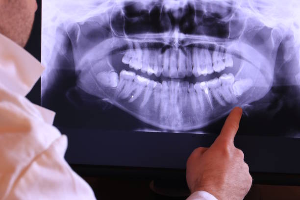 Best Tooth Infection Emergency Dentist  in Olyphant, PA