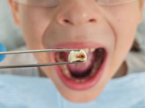 Best Broken Tooth Emergency  in Olyphant, PA